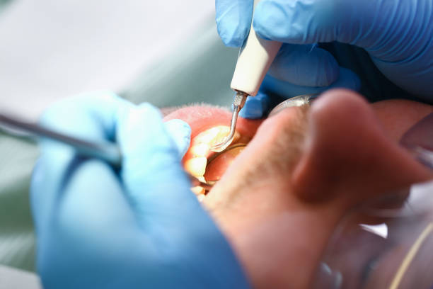 Best Emergency Dental Extractions in Guin, AL