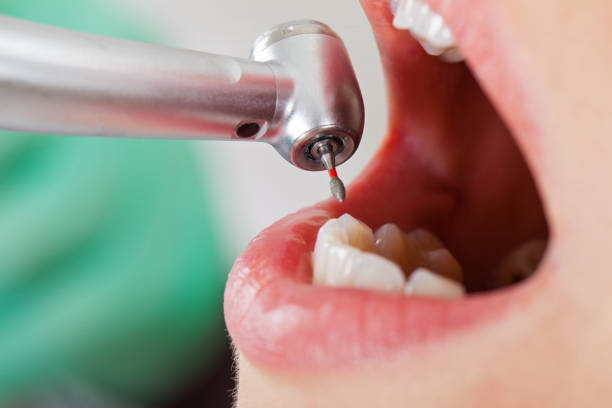 Best Broken or Cracked Tooth Emergency Dentist in Guin, AL